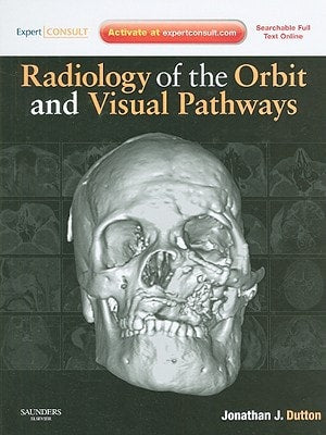 Radiology of the Orbit and Visual Pathways
