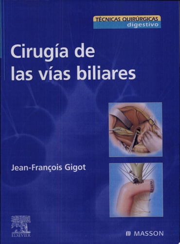 Cirugía de las vías biliares