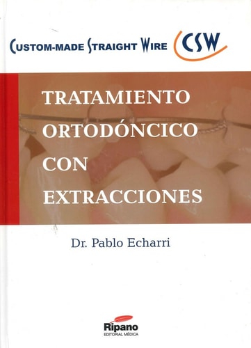 Tratamiento ortodóncico con extracciones